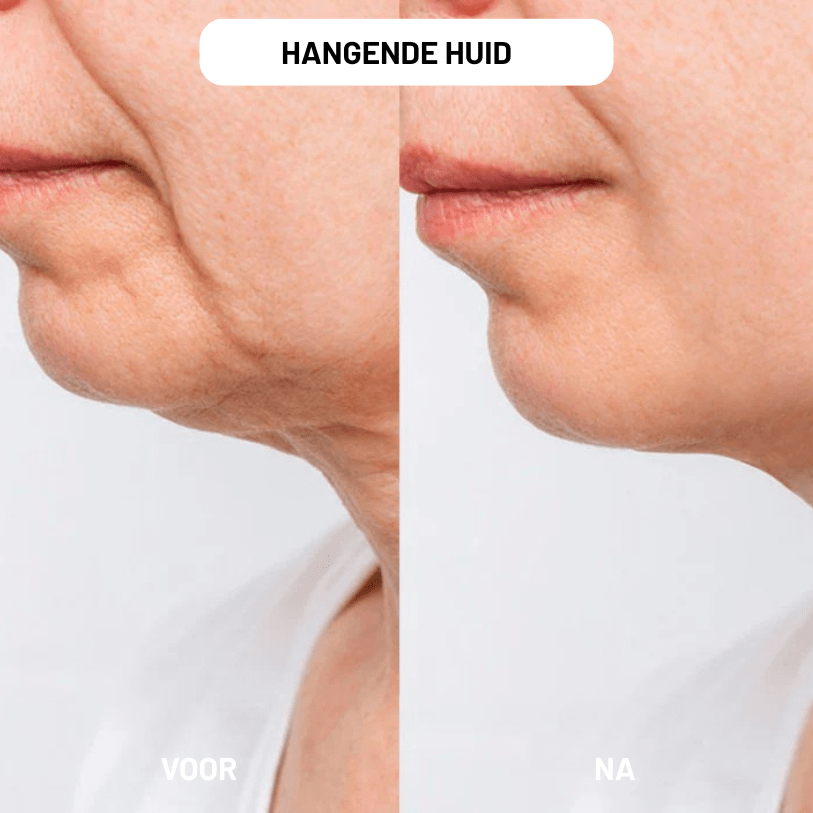 NAD+ Restore for Women